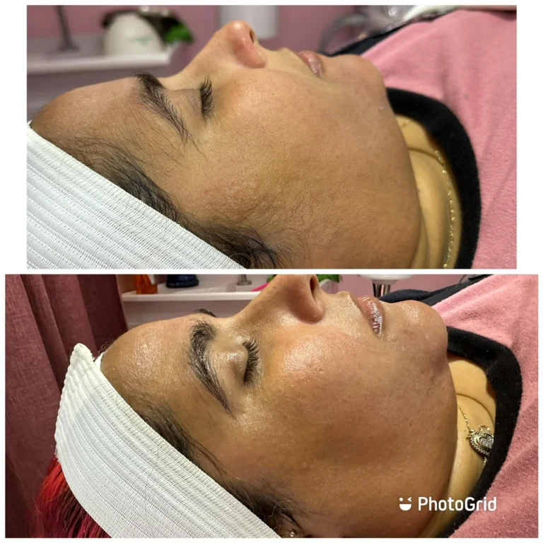 Tratamientos avanzados, Damaris Esthetic & Spa, servicios, galería