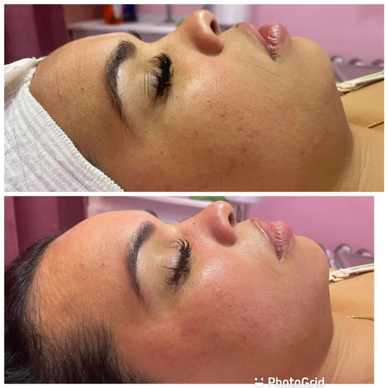 Tratamientos avanzados, Damaris Esthetic & Spa, servicios, galería