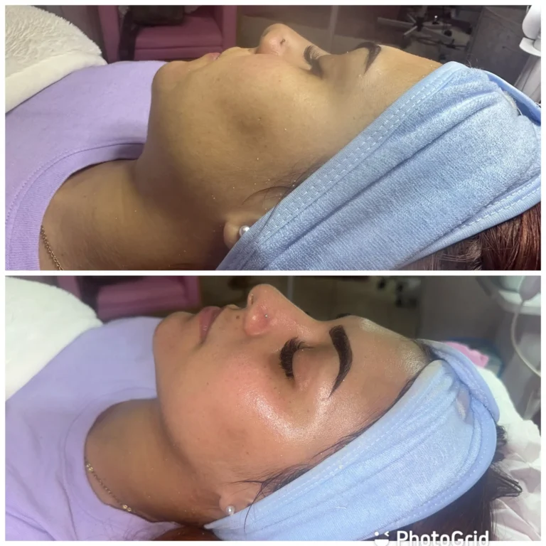 Tratamientos avanzados, Damaris Esthetic & Spa, servicios, galería