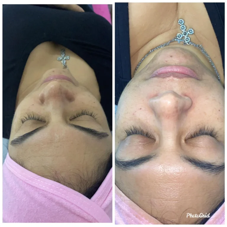 Tratamientos avanzados, Damaris Esthetic & Spa, servicios, galería